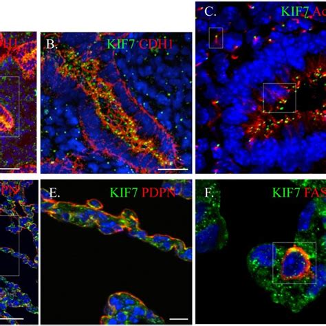 KIF7 Regulates Microtubule Mstability In Mouse Lung Epithelial MLE15