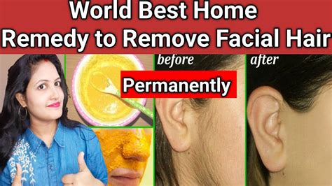 How To Remove Facial Hair Permanently 100 Natural Home Remedy