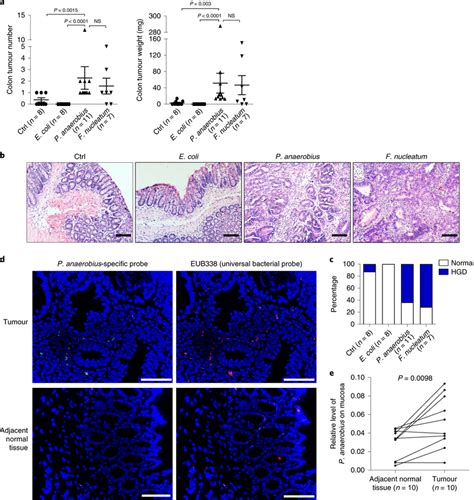 P Anaerobius Promotes Colonic Tumorigenesis In ApcMin Mice A