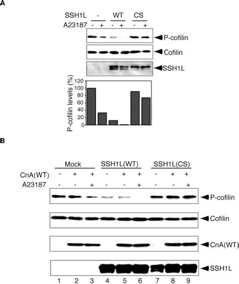 Calcium Signal Induced Cofilin Dephosphorylation Is Mediated By