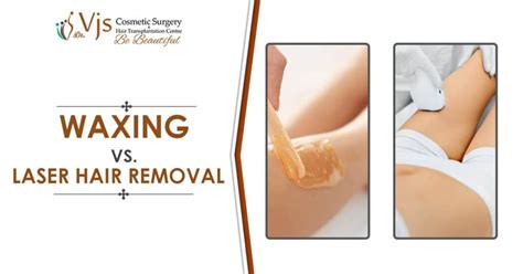 Laser Hair Removal Vs Waxing Hair Removal Or Depilation Vector Poster