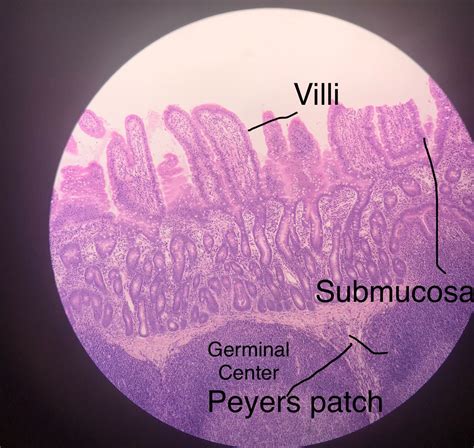 Peyer S Patch Histology