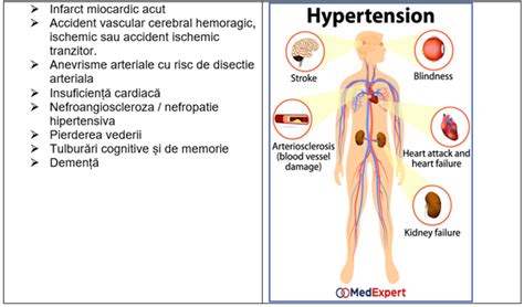 Hipertensiunea Arteriala Cauze Tratament Preventie Medexpert Blog