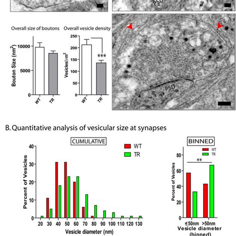 Ultrastructural Alterations In Div 21 Human α Synuclein Over Expressing