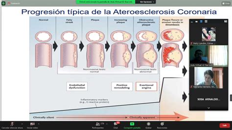 Cardiopatia Isqu Mica Angina Estable Medicina Interna Clase