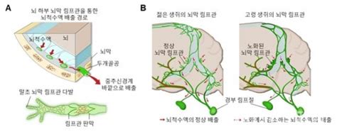 세계 최초 ‘치매 유발 뇌 속 노폐물 배출 림프관 찾았다