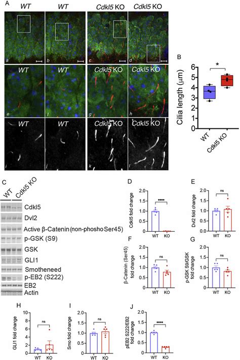 Cdkl5 Mice Have Increased Cilia Length But No Changes In Components Of