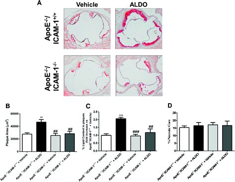 Essential Role Of Icam In Aldosterone Induced Atherosclerosis