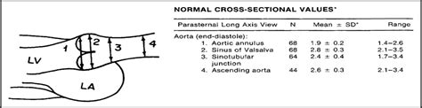 Approach to the dilated aortic root : Current Opinion in Cardiology