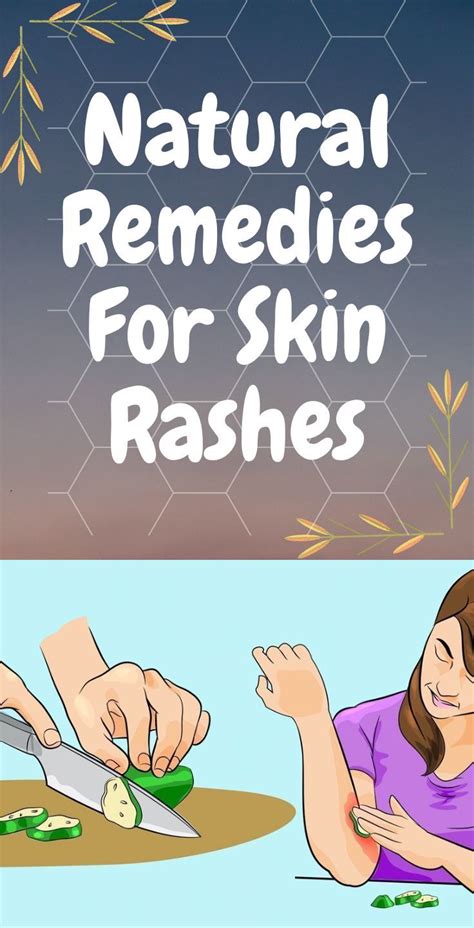 Irritated skin? Here are 9 all-natural remedies to treat your skin the ...