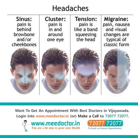 pressure points for headache relief diagram - angel-hodgins