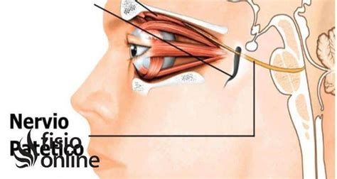 Troclear Nervio Qu Es D Nde Se Origina Recorrido Ramificaciones
