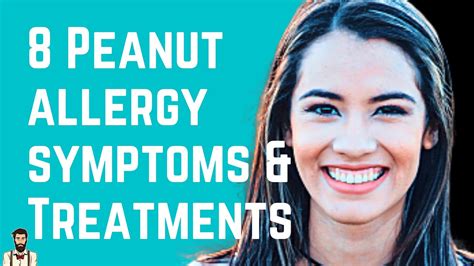 8 Peanut Allergy Symptoms And Treatments The Root Problem Youtube