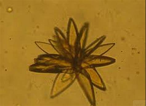 Variations Of Uric Acid Crystals In Urine Medical Laboratories