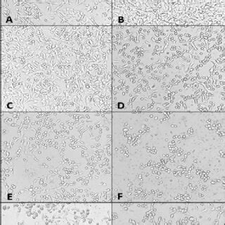 Photomicrograph Of Mda Mb Cells Examined Under Light Inverted