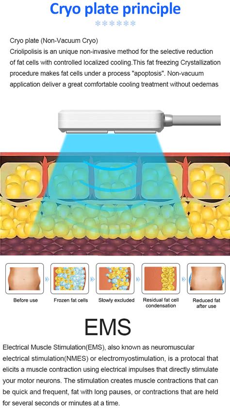 Cryotherapy Cryo Toning Facials Cryogenic Skin Tightening Rejuvenation