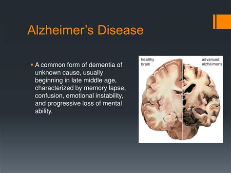 Ppt Alzheimers Disease Powerpoint Presentation Free Download Id