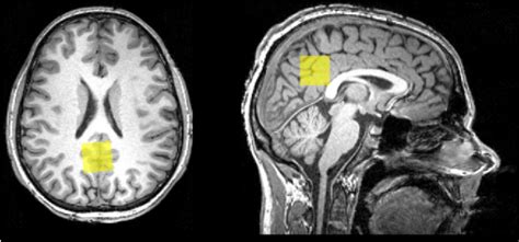 Figure 1 from GABA Concentration in Posterior Cingulate Cortex Predicts ...