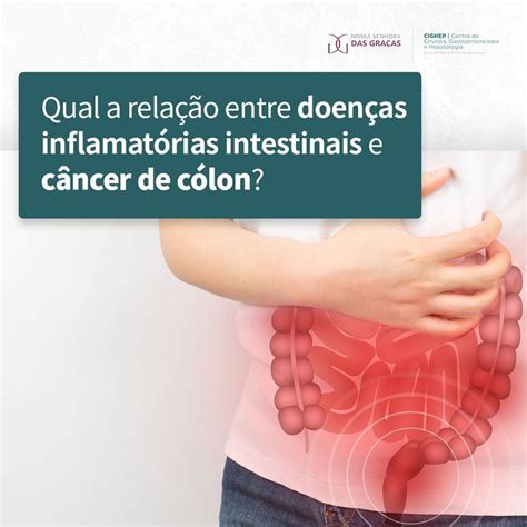 Qual A Relação Entre Doenças Inflamatórias Intestinais E Câncer De