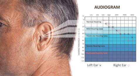 Industrial Deafness Claims Explained Loud And Clear Vbr Lawyers