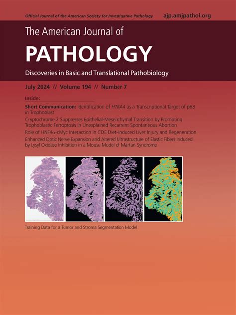 Gut Microbemediated Suppression Of Inflammation Associated Colon