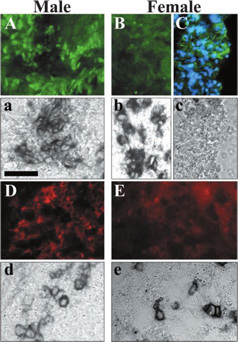 SOX9 and AMH expression in gonad cultures. Dissected pairs of genital ... 
