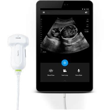 Philips Healthcare Lumify