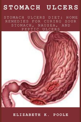 Stomach Ulcers Stomach Ulcers Diet Home Remedies For Curing Sour Stomach Nausea And Peptic