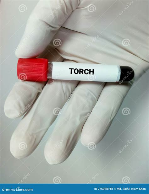 blood sample  torch test torch panel stock photo image