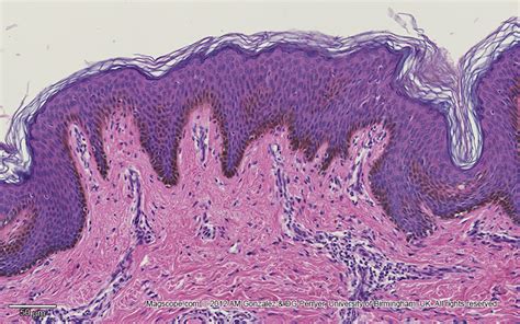 Epidermis Histology