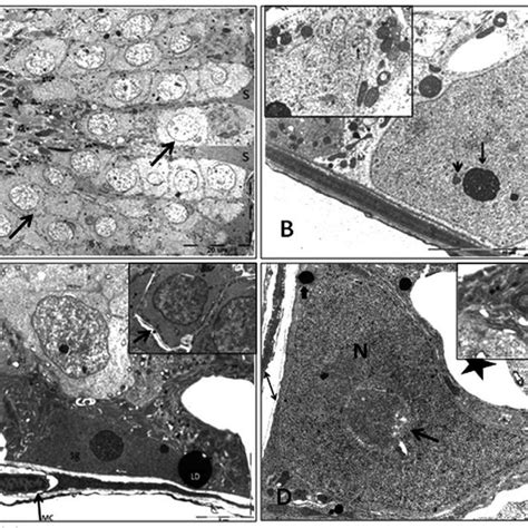 A Control Rat Testis Showing Multiple Cross Sections In Seminiferous