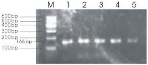 Pcr Product Of The Myod1 Gene Exon 1 And Its Flanking Region M