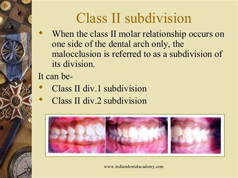 Classification Of Malocclusion1