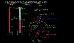 ESR Blood Test Results Explained - HRF