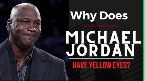 Why Does Michael Jordan Have Yellow Eyes Celebrities Health Issues 1