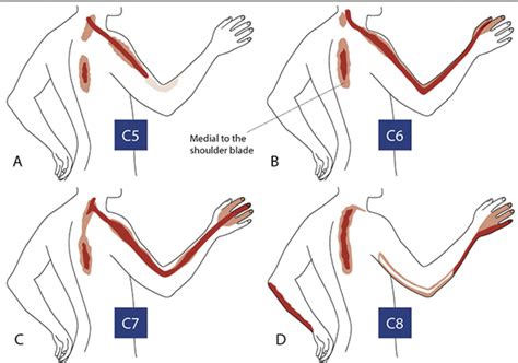 Secrets Of How To Recovery From Shoulder Blade Pain