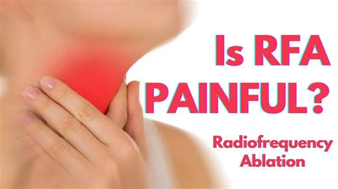 Radiofrequency Ablation (RFA) for thyroid nodules painful?