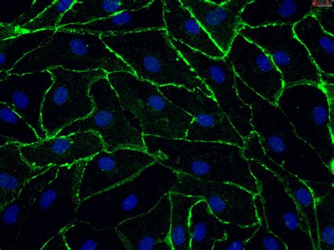 Human Rectal Microvascular Endothelial Cells HRecMEC