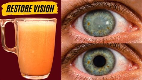 Just 1 Minute Restore Vision Naturally With Secret Morning Drink