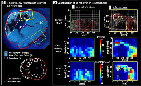 Assessment Of Coronary Microcirculation Alterations In A Porcine Model