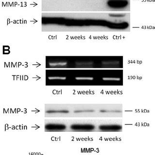 Expression Levels Of Mmp Collagenase And Mmp Stromelysin