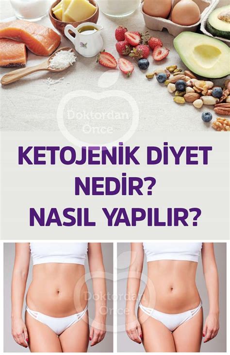 Ketojenik diyet nedir Doktordan Önce