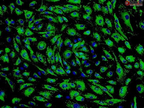 Human Pulmonary Microvascular Endothelial Cells HPMEC