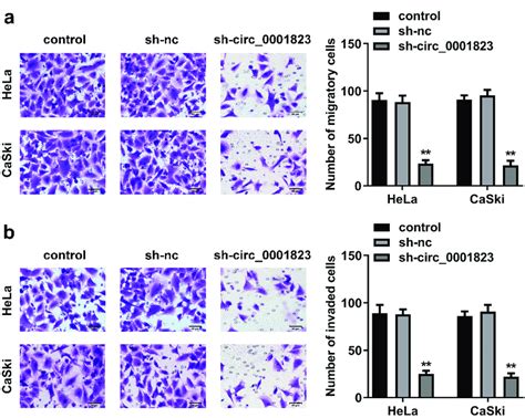 Circ 0001823 Silenced Inhibited The Malignant Behavior Of The CC Cells