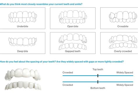 Invisalign Pictures Template