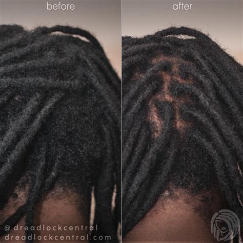 Atlanta Dreadlocks And Instant Locs • Installation • Repair • Extensions