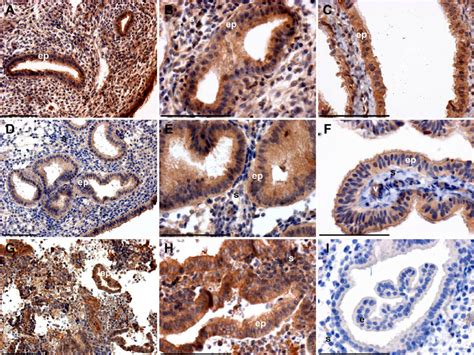 Immunohistochemical Localization Of Adam In Human Endometrium And