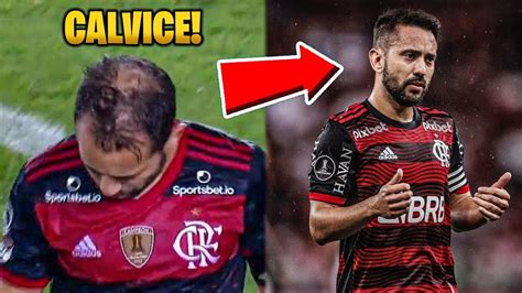 N O Foi S Everton Ribeiro Veja Antes E Depois De Jogadores Que