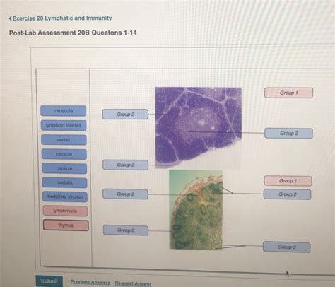 Solved Exercise Lymphatic And Immunity Chegg