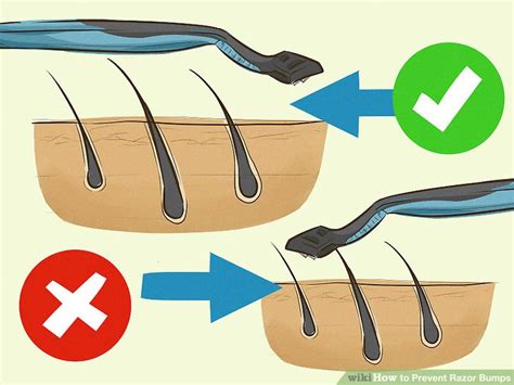 How To Prevent Razor Bumps With Pictures Wikihow